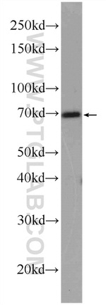 PRKG1 Antibody in Western Blot (WB)