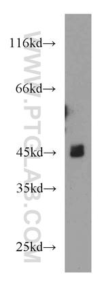 GIRK2 Antibody in Western Blot (WB)