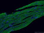 Cardiac Troponin I Antibody in Immunohistochemistry (PFA fixed) (IHC (PFA))