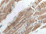 Cardiac Troponin I Antibody in Immunohistochemistry (Paraffin) (IHC (P))