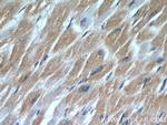 Cardiac Troponin I Antibody in Immunohistochemistry (Paraffin) (IHC (P))