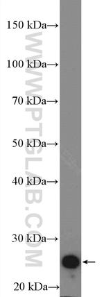 Cardiac Troponin I Antibody in Western Blot (WB)