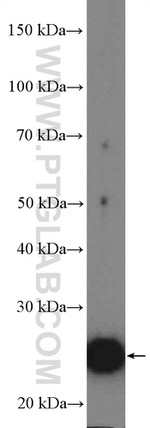 Cardiac Troponin I Antibody in Western Blot (WB)