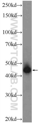 HOXB1 Antibody in Western Blot (WB)