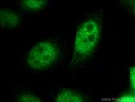 CDX1 Antibody in Immunocytochemistry (ICC/IF)