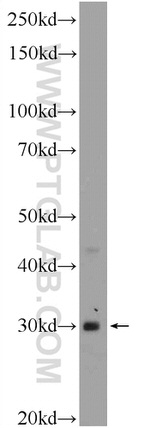 CDX1 Antibody in Western Blot (WB)