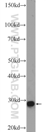 CDX1 Antibody in Western Blot (WB)