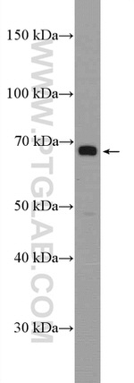 KCNA5 Antibody in Western Blot (WB)