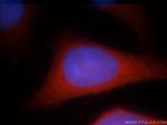 RAB3GAP1 Antibody in Immunocytochemistry (ICC/IF)