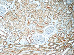 RAB3GAP1 Antibody in Immunohistochemistry (Paraffin) (IHC (P))