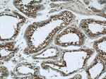 RAB3GAP1 Antibody in Immunohistochemistry (Paraffin) (IHC (P))