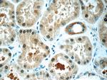 RAB3GAP1 Antibody in Immunohistochemistry (Paraffin) (IHC (P))