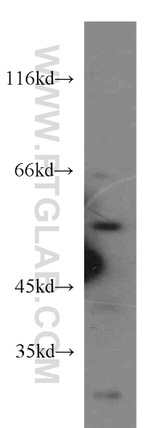 SESN1 Antibody in Western Blot (WB)