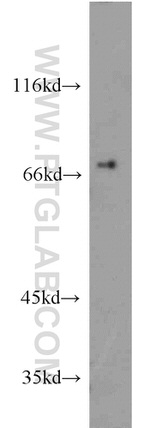 SESN1 Antibody in Western Blot (WB)