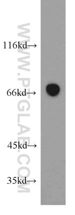 SESN1 Antibody in Western Blot (WB)