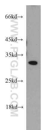 SIP1 Antibody in Western Blot (WB)