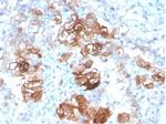 Fatty Acid Binding Protein (Liver)/FABP1 Antibody in Immunohistochemistry (Paraffin) (IHC (P))