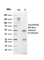 Fatty Acid Binding Protein (Liver)/FABP1 Antibody in Immunoelectrophoresis (IE)