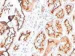 Fatty Acid Binding Protein (Liver)/FABP1 Antibody in Immunohistochemistry (Paraffin) (IHC (P))