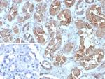 Fatty Acid Binding Protein (Liver)/FABP1 Antibody in Immunohistochemistry (Paraffin) (IHC (P))