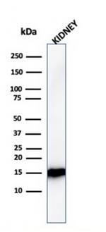 Fatty Acid Binding Protein (Liver)/FABP1 Antibody in Western Blot (WB)