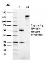 Fatty Acid Binding Protein (Liver)/FABP1 Antibody in SDS-PAGE (SDS-PAGE)