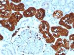 Fatty Acid Binding Protein (Liver)/FABP1 Antibody in Immunohistochemistry (Paraffin) (IHC (P))