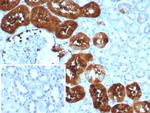 Fatty Acid Binding Protein (Liver)/FABP1 Antibody in Immunohistochemistry (Paraffin) (IHC (P))