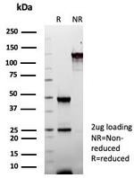 Fatty Acid Binding Protein (Liver)/FABP1 Antibody in SDS-PAGE (SDS-PAGE)