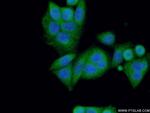 NF2 Antibody in Immunocytochemistry (ICC/IF)