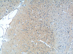 NF2 Antibody in Immunohistochemistry (Paraffin) (IHC (P))