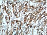 NF2 Antibody in Immunohistochemistry (Paraffin) (IHC (P))