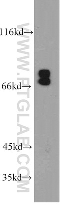 NF2 Antibody in Western Blot (WB)