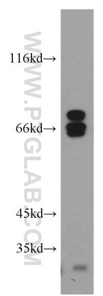 NF2 Antibody in Western Blot (WB)