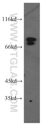 NF2 Antibody in Western Blot (WB)