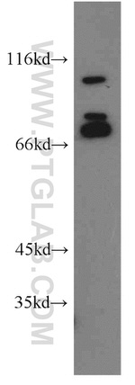 NF2 Antibody in Western Blot (WB)