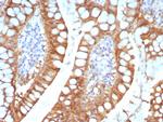 FABP2 (Marker of Metastatic Potential in Colorectal Cancer) Antibody in Immunohistochemistry (Paraffin) (IHC (P))