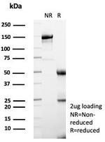 FABP2 (Marker of Metastatic Potential in Colorectal Cancer) Antibody in SDS-PAGE (SDS-PAGE)