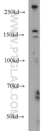 ODZ1 Antibody in Western Blot (WB)