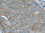NEDD4 Antibody in Immunohistochemistry (Paraffin) (IHC (P))