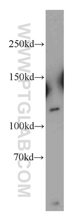 NEDD4 Antibody in Western Blot (WB)