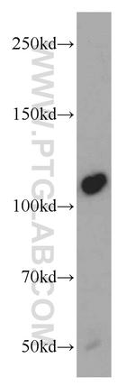 NEDD4 Antibody in Western Blot (WB)