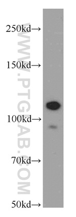 NEDD4 Antibody in Western Blot (WB)