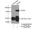 DCLK1 Antibody in Immunoprecipitation (IP)