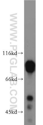 DCLK1 Antibody in Western Blot (WB)