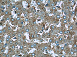 UQCRC1 Antibody in Immunohistochemistry (Paraffin) (IHC (P))