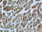 UQCRC1 Antibody in Immunohistochemistry (Paraffin) (IHC (P))