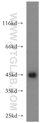 UQCRC1 Antibody in Western Blot (WB)