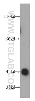 UQCRC1 Antibody in Western Blot (WB)