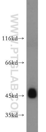 UQCRC1 Antibody in Western Blot (WB)